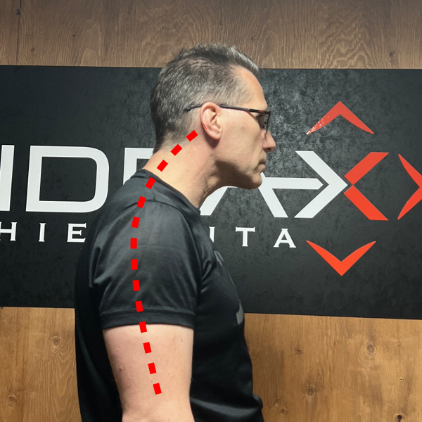 Pää%20työntynyt%20eteenpäin